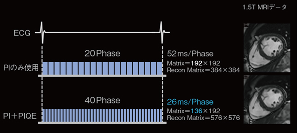 図3　R-R間隔における時相数のイメージ図