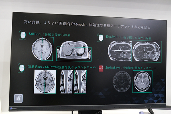 後処理で各種アーチファクトの低減や画質のコントロールを可能とする「IQ Retouch」
