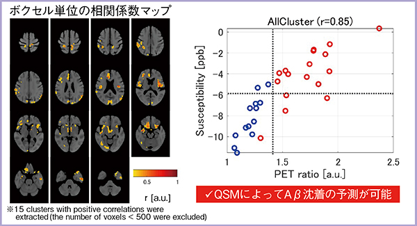 図2　QSMとアミロイドPETの相関（患者間）