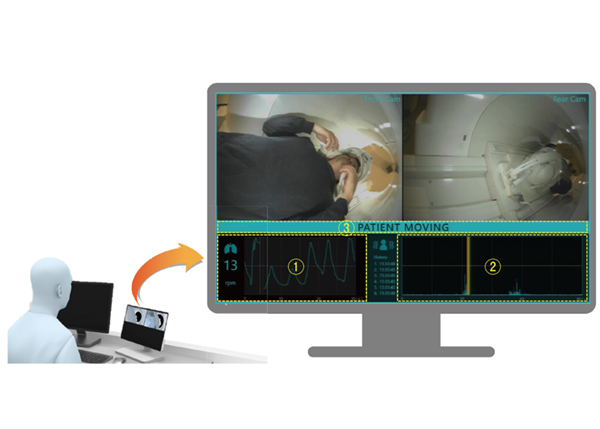図1 Synergy Visionモニタ モニタには(1) 呼吸動波形と(2) 体動波形が表示され,MRI検査中に被検者がガントリからはい出してくるような大きな動き,咳やくしゃみのような小さな動きを検出し,(3) 体動発生を操作者に通知する。 図1 Synergy Visionモニタ モニタには(1) 呼吸動波形と(2) 体動波形が表示され,MRI検査中に被検者がガントリからはい出してくるような大きな動き,咳やくしゃみのような小さな動きを検出し,(3) 体動発生を操作者に通知する。