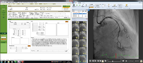 図2　心臓カテーテル検査のレポート画面