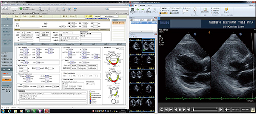 図3　循環器超音波検査のレポート画面