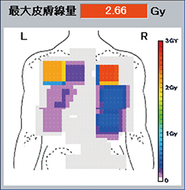 図1　PCI
