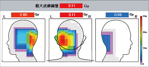 図2　NEURO IVR