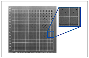 図1　CDRADファントム