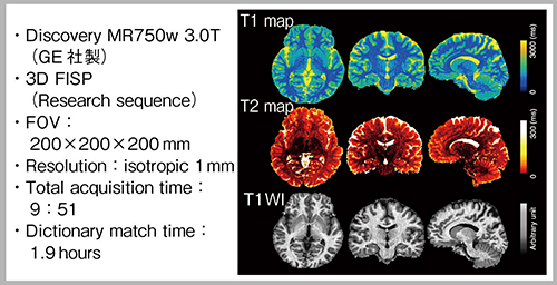 図1　3D MR fingerprinting