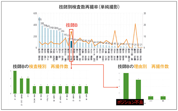 図2　診療放射線技師別再撮影率