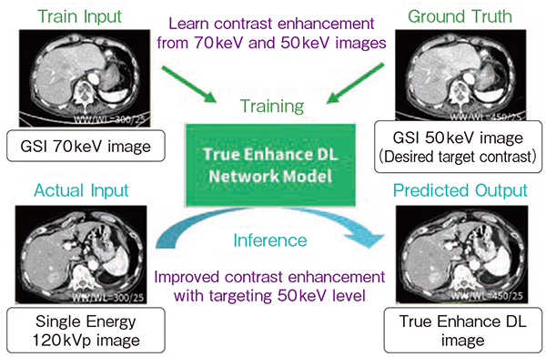 図1　True Enhance DLの学習と推論の仕組み