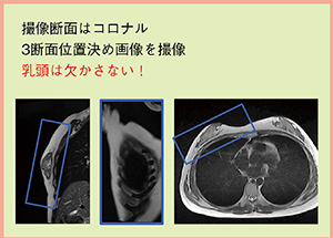 図3　RVS用MRI撮像のポイント