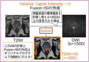 図1　フュージョンrSIの作成