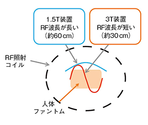 図3　3T MRIにおけるRF照射