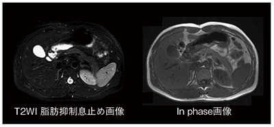 図7　3T腹部画像例