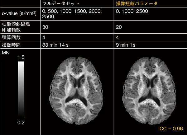 図4　フルデータと撮像短縮パラメータで得られたデータによるDKI（MK）の比較