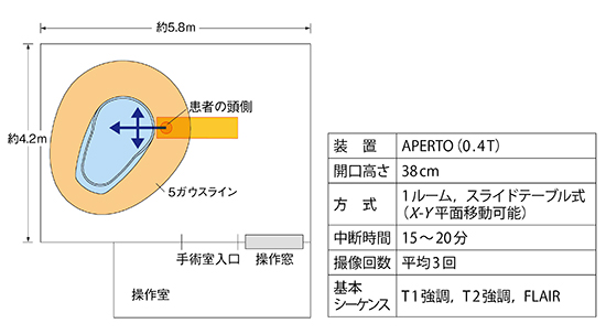 インテリジェント手術室のレイアウト（MRI以外の設備・機器は省略）