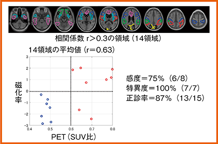 図4　QSMとアミロイドPETの比較