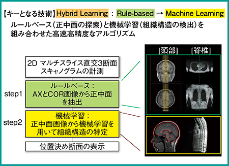 図2　自動位置決めによる撮像の容易化1），2）