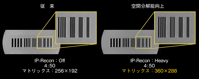 図8　IP-Recon を活用した空間分解能の向上