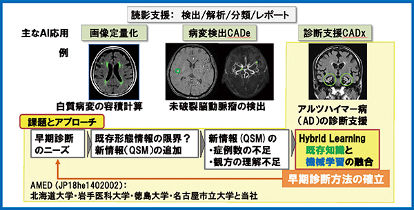 図1　読影支援に対するAI応用