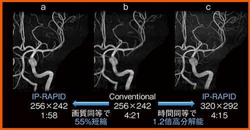図1　IP-RAPIDを使用した頭部MRA画像