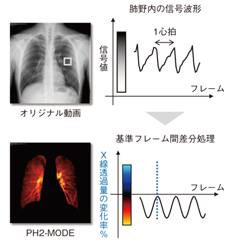 図4 PH2-MODEアルゴリズム 図4 PH2-MODEアルゴリズム
