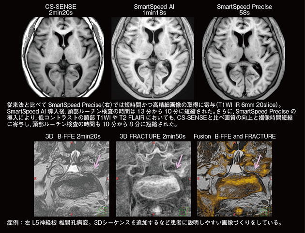 Ingenia Elition 3.0Tの臨床画像