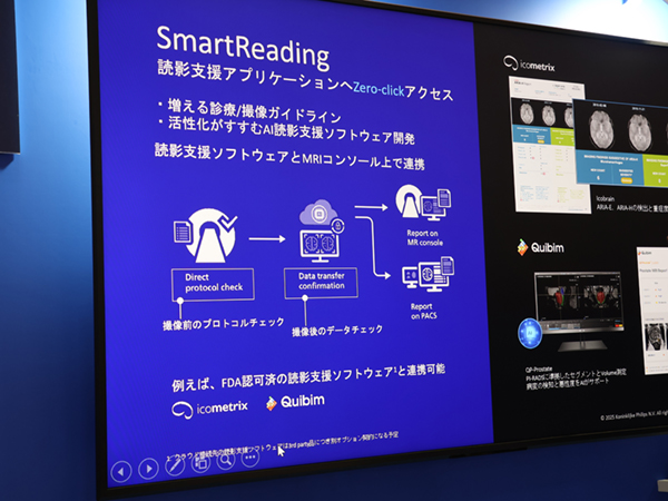 ゼロクリックでクラウド型AI読影支援ソフトウエアと連携する「Smart Reading」
