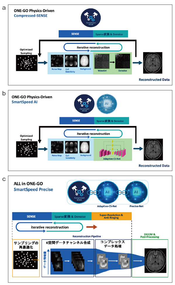 図1　フィリップス画像再構成プラットフォームの変遷 a：C-SENSE b：SmartSpeed AI c：SmartSpeed Precise