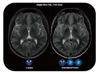 図2　シングルショット全脳T2強調画像7秒スキャン （プロトコールご提供：北海道大学病院・藤間憲幸先生）
