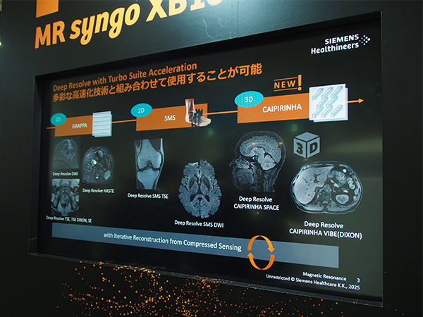 AIを用いた超解像画像再構成技術「Deep Resolve」が3Dに対応