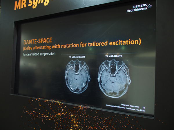 DANTEとSPACEの併用によりT1コントラストを保ちつつ血液信号を抑制