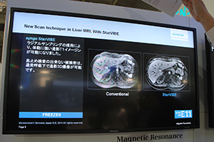 体動補正シーケンスのFREEZEItを発表