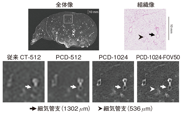 図2　従来CTとPCD-CTによる細気管支の描出能の比較（参考文献2）より引用転載）