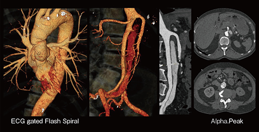 図5　超高速撮影による心血管の描出