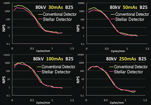 図4　Noise Power Spectrum（NPS）の変化