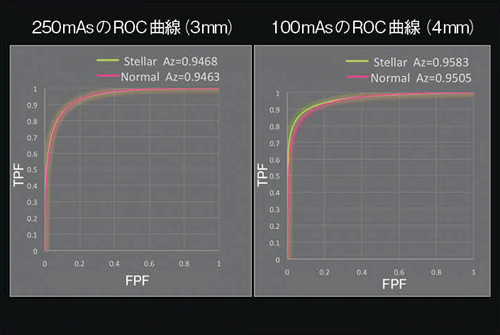 図5　低コントラスト検出能（ROC解析）