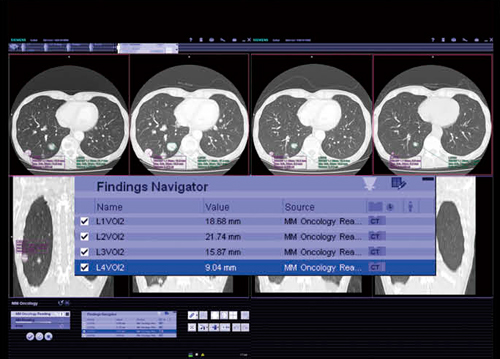 図7　MM Oncology 標的病変の選択