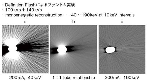 図5　 metal artifact reductionのファントム実験3）