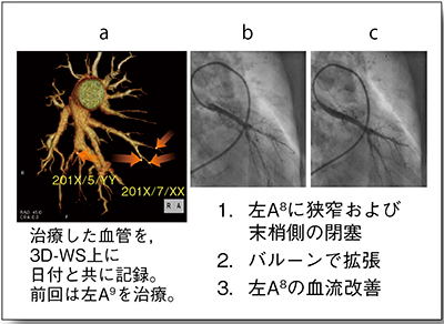 図5　症例4：術中ガイド