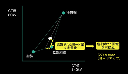 図1　Three-material decomposition法によるヨードマップ画像の作成