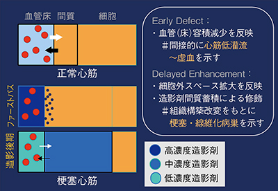 図2　心筋組織構築と造影効果の関連