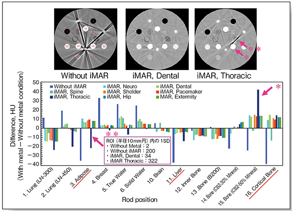 図3　iMARの定量評価