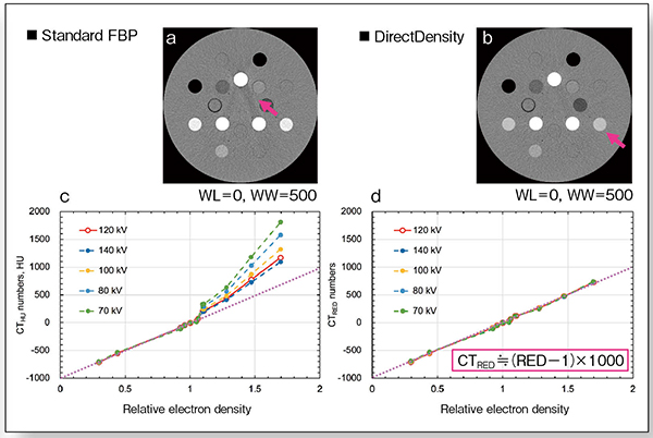 図4　FBPとDirectDensityの特性比較