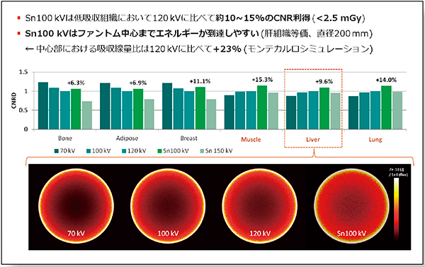 図4　低線量撮影時のCNRDと吸収線量