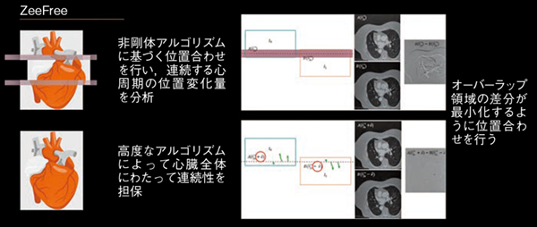 図4 ZeeFreeのアルゴリズム 図4 ZeeFreeのアルゴリズム