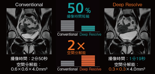 図3　Deep Resolveにより2倍の空間分解能で撮像時間を50%削減