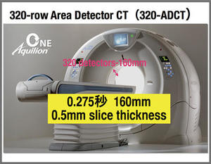 図1　320列ADCT「Aquilion ONE/ViSION Edition」の特徴