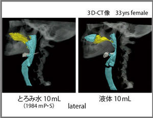 図15　とろみ水と液体の嚥下動態の比較