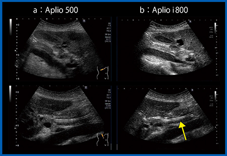 図1　Aplio 500の従来プローブ（a）とAplio i800の新プローブ（b）の比較