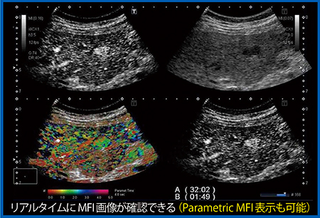 図3　症例1：QuadView