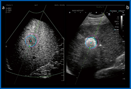 図3　US-US Fusion Imaging